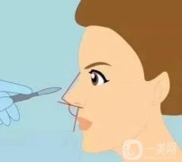 玻尿酸隆鼻術(shù)后有什么注意事項(xiàng)