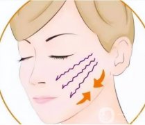 PST面部除皺的價(jià)格與哪些因素有關(guān)
