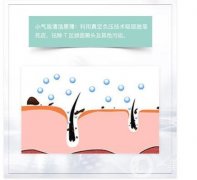 超微小氣泡的步驟是怎么樣的
