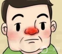 如何降低酒渣鼻的風(fēng)險(xiǎn)