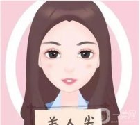 影響美人尖種植價(jià)格的因素有哪些？