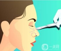 玻尿酸隆鼻后鼻翼越來(lái)越寬怎么辦？