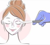 超聲刀的副作用是什么？哪些人不適合