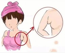 副乳房切除術(shù)有什么好處和并發(fā)癥