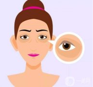 激光去除黑眼圈的優(yōu)點有哪些？