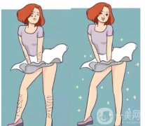 激光脫毛去腿毛的注意事項有哪些