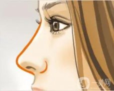 玻尿酸隆鼻鼻子會(huì)歪嗎，會(huì)變形嗎