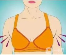 副乳切除術(shù)后應(yīng)該怎樣做才能促進(jìn)康復(fù)