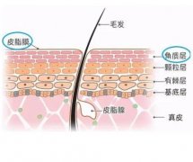 做果酸換膚可以祛痘嗎，要注意什么