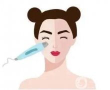 激光潔膚可以祛斑嗎？效果怎么樣