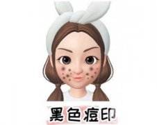 做皮秒就能去除痘印嗎