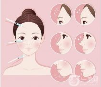 自體脂肪填充后洗臉有哪些注意事項(xiàng)？