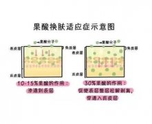 做果酸換膚前后要注意什么？