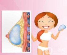 假體隆胸手術后需要如何護理