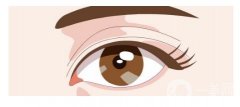 開眼角是開內(nèi)眼角還是外眼角