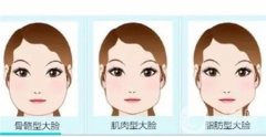 面部吸脂手術(shù)痛嗎？效果可以永久性嗎
