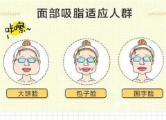 面部吸脂手術(shù)適合哪些人