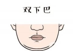 雙下巴吸脂需要多長(zhǎng)時(shí)間才能消腫
