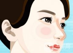 膨體鼻整形術(shù)有什么優(yōu)點(diǎn)？
