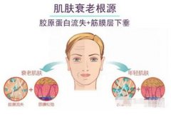 熱瑪吉后需要多長時間才能恢復(fù)