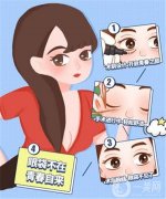 眼袋手術會影響視力嗎？