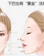 假體墊下巴和假體墊下巴有什么區(qū)別？