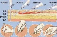 去除疤痕后應(yīng)該怎么護理