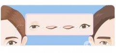 切眉手術(shù)有什么好處？多久可以拆線