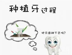 種植牙疼嗎？種植牙后會疼嗎