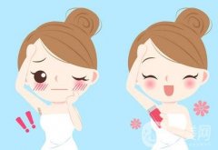 激光脫毛前要做哪些準(zhǔn)備工作