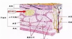 自體脂肪填充法令紋的價(jià)格是多少