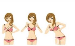矯正乳房下垂有什么好處，哪些人適合