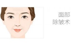 去除面中部皺紋的方法和適應癥