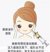 下頜吸脂術(shù)有哪些優(yōu)點，哪些人適合