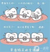 地包天如何矯正？如何預(yù)防