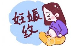 激光去除妊娠紋的優(yōu)勢有哪些