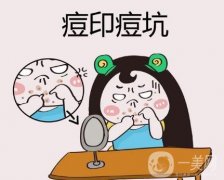 激光祛痘印要多久才能見效