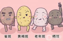 激光祛斑的價(jià)格是多少