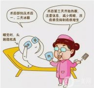 雙眼皮失敗修復手術的效果和步驟