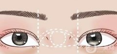 開(kāi)內(nèi)眥和開(kāi)外眥有哪些區(qū)別