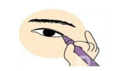 開(kāi)眼角的腫脹需要多長(zhǎng)時(shí)間才能消退