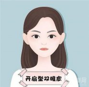埋線雙眼皮效果可以永久維持嗎？