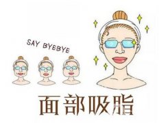面部吸脂適合哪些人做