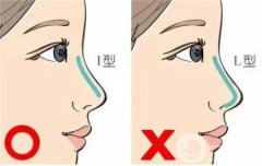 硅膠假體隆胸后的硅膠可以去掉嗎?