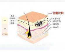 彩光嫩膚可以解決哪些皮膚問題？