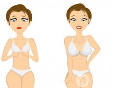 乳頭縮小手術(shù)有哪些優(yōu)點(diǎn)