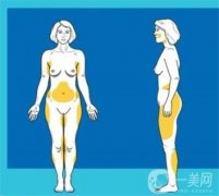 溶脂注射的功效怎么樣，優(yōu)點(diǎn)有哪些