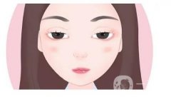 如何避免開眼角的危險？