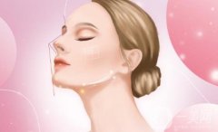 提眼瞼手術(shù)是如何進(jìn)行的？？