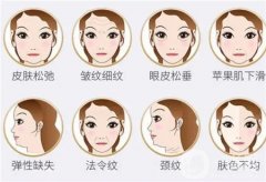 填充法令紋的效果能維持多久？